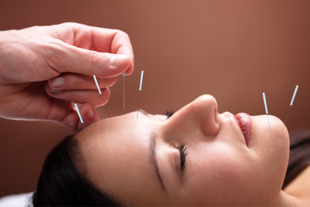 what are the benefits of traditional chinese medicine